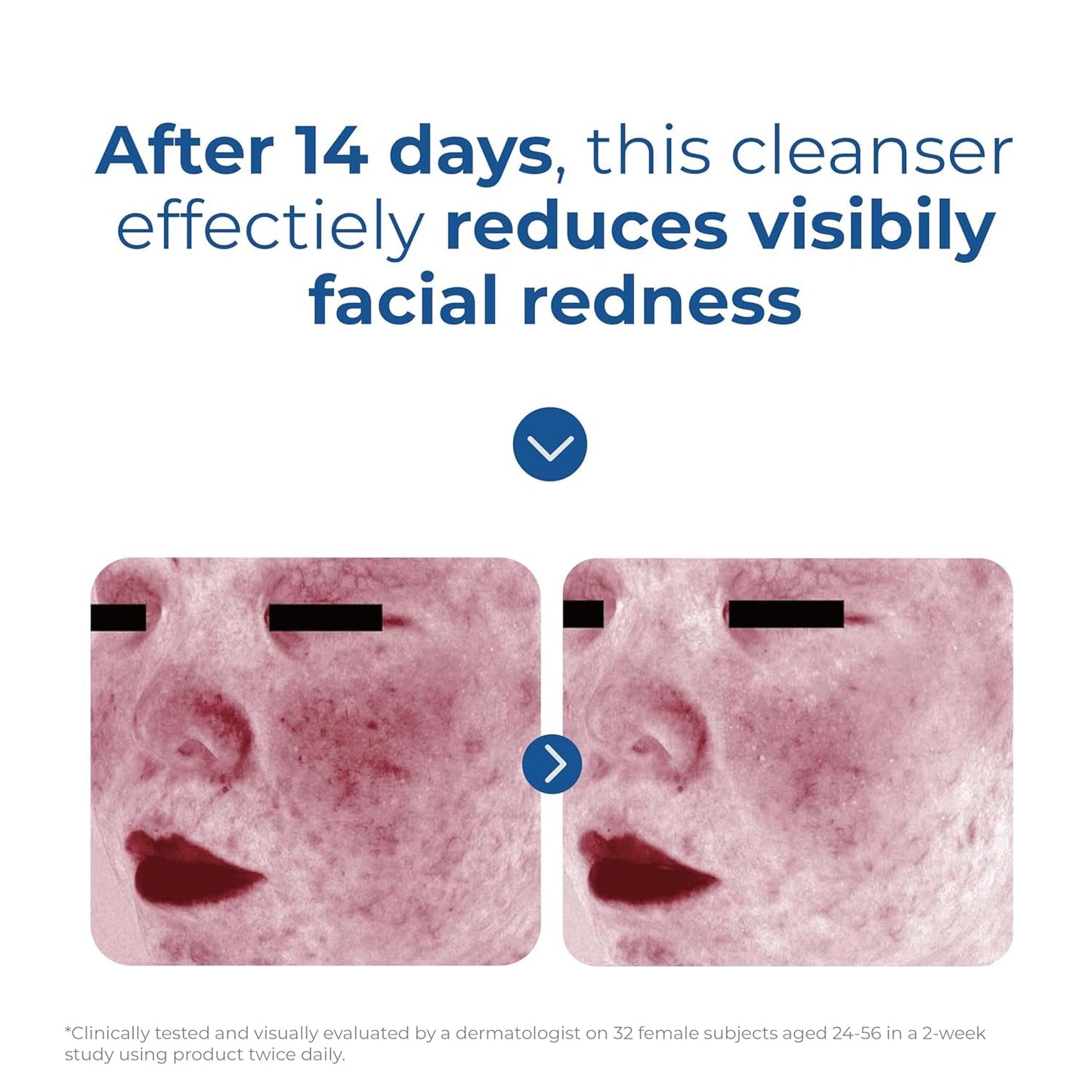 EltaMD Skin Recovery Amino Acid Foaming Facial Cleanser, Gentle Face Cleanser for Sensitive Skin, 1.0 Fl Oz